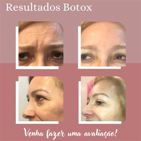 CONSULTÓRIO DE ESTÉTICA AVANÇADA EM JATAÍ - GO