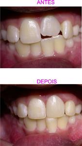 ODONTOPEDIATRIA E ESTETICA DENTARIA EM PETROPOLIS