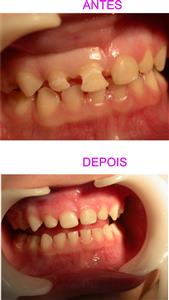 ODONTOPEDIATRIA E ESTETICA DENTARIA EM PETROPOLIS